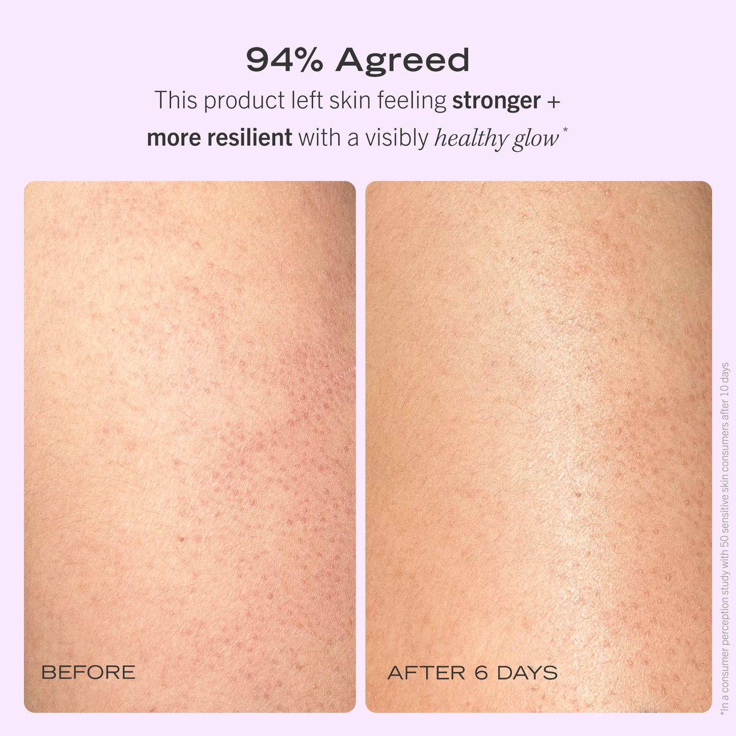 Skin Before and After 6 days of using Nourishing Body Oil.  94% Agreed that the Nourishing Body Oil left skin feeling stronger + more resilient with a visibly healthy glow.