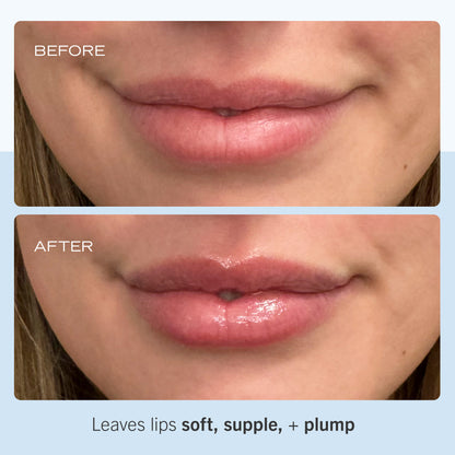 Ultra Repair Lip Balm