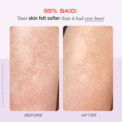 Skin Before and After using KP Bump Eraser Body Scrub Fresh Strawberry.  95% Said: Their skin felt softer than it had ever been.