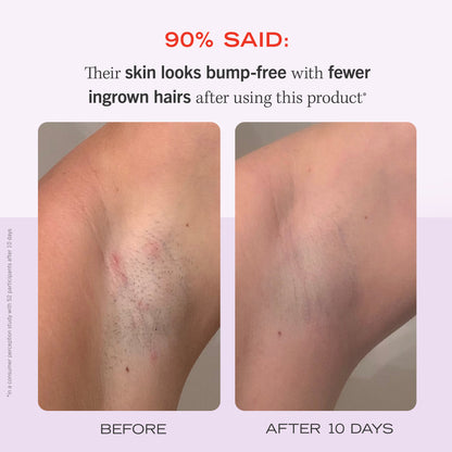 Images of Before and After 10 Days.  90% Said: Their skin looks bump-free with fewer ingrown hairs after using this product.